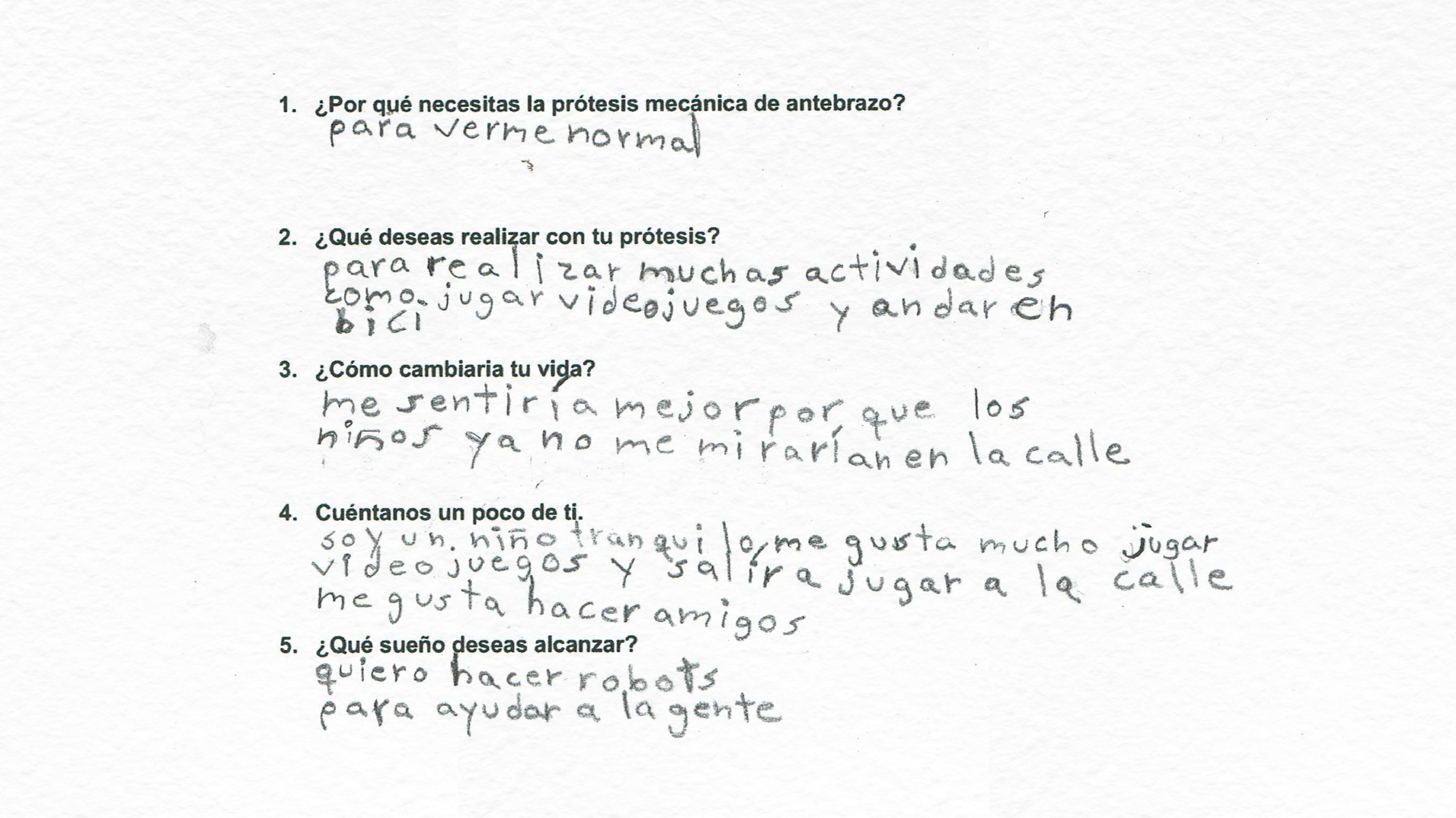 “Quiero una prótesis para verme normal”